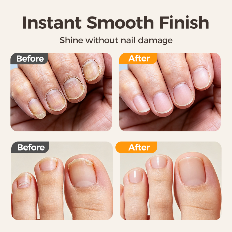 💅 2-in-1 Electric Nail Clipper & Smoother 🌟
